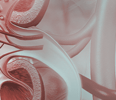 Peritoneal Dialysis
