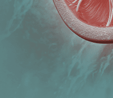 Hematuria
