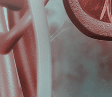 Kidney Cysts