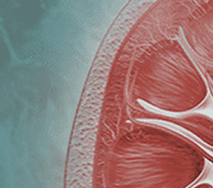Peritoneal Dialysis - San Antonio Kidney