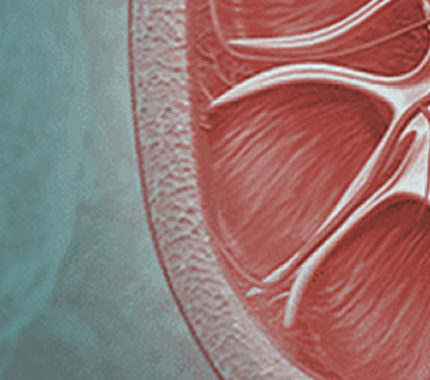 Hematuria - San Antonio Kidney